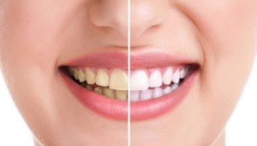 Transform Your Smile: The Artistry of Cosmetic Dentistry Unveiled