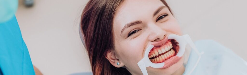 Smile Bright: Unveiling the Power of Fluoride for Dental Health – A Comprehensive Guide by 4smile.